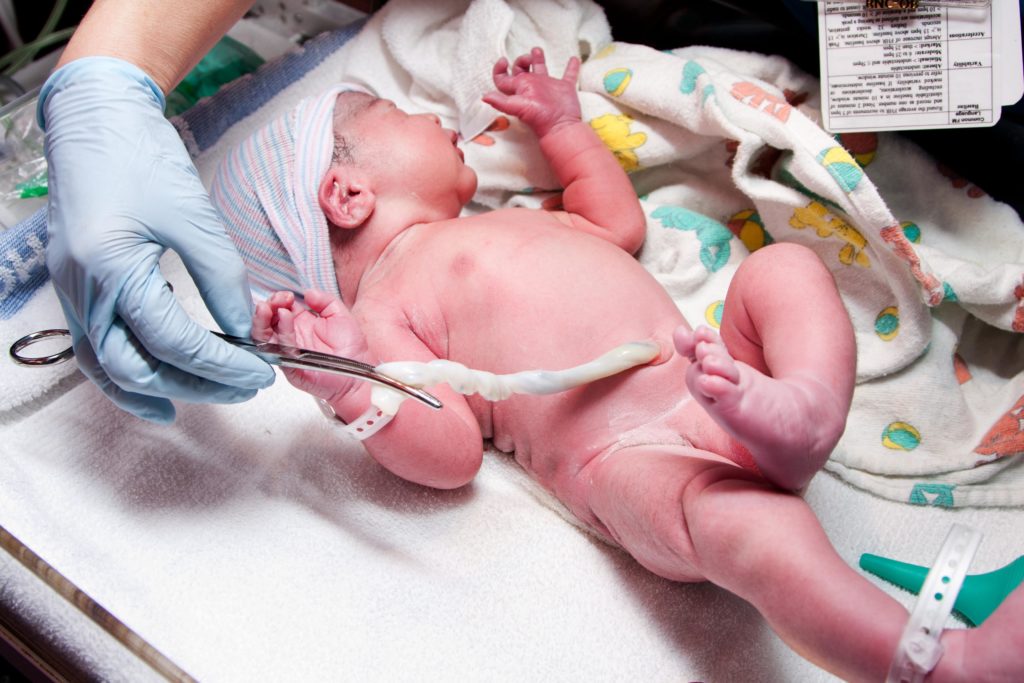 What do you know about the umbilical cord? Do you know what it's for? Is delayed cord clamping part of your birth plan? Find out everything you need to know about the umbilical cord